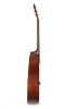 Side